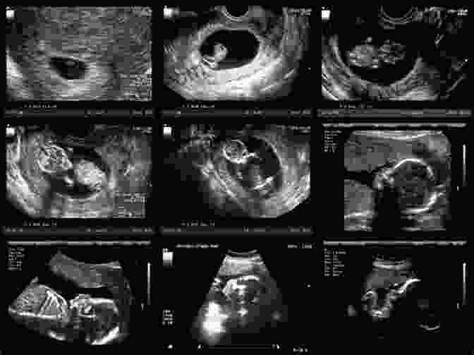 Week By Week Ultrasound Images Of A Growing Baby Pregnancy Week By Week: Understand The Changes And Chart The Progress Of You And Your Baby With This Essential Weekly Planner